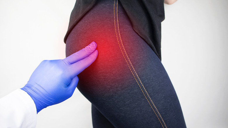 Woman with sciatica nerve pain in the buttocks