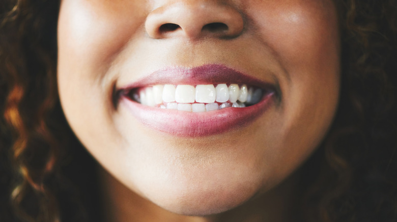 Woman showing teeth