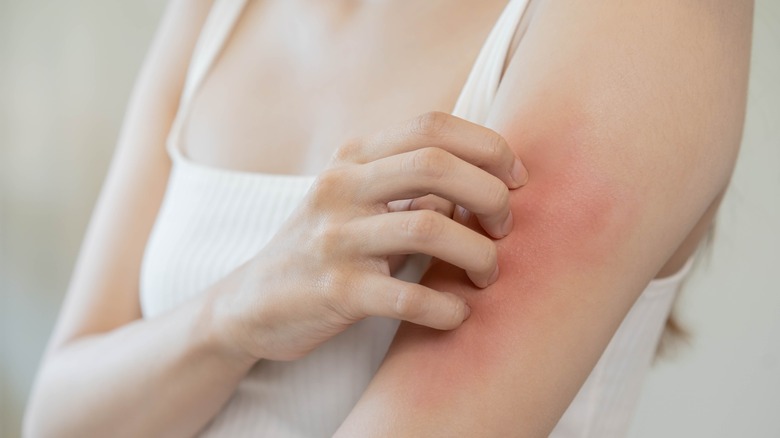 woman scratching skin