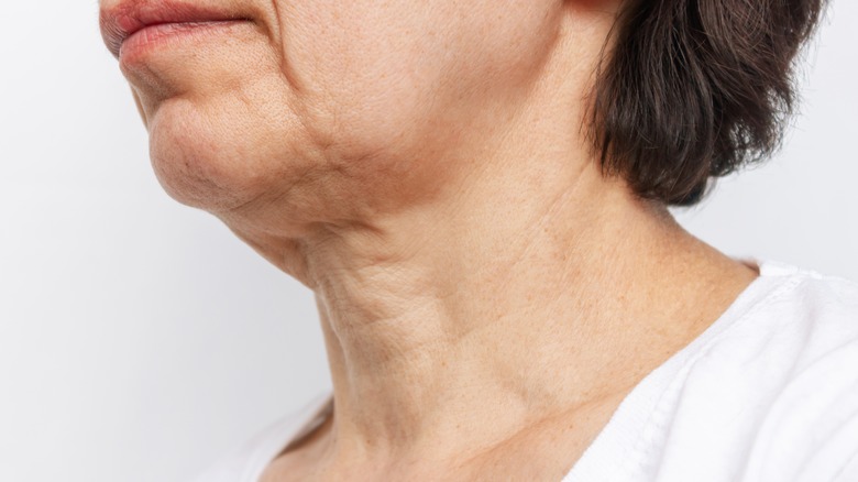 elderly white woman's neck with saggy skin