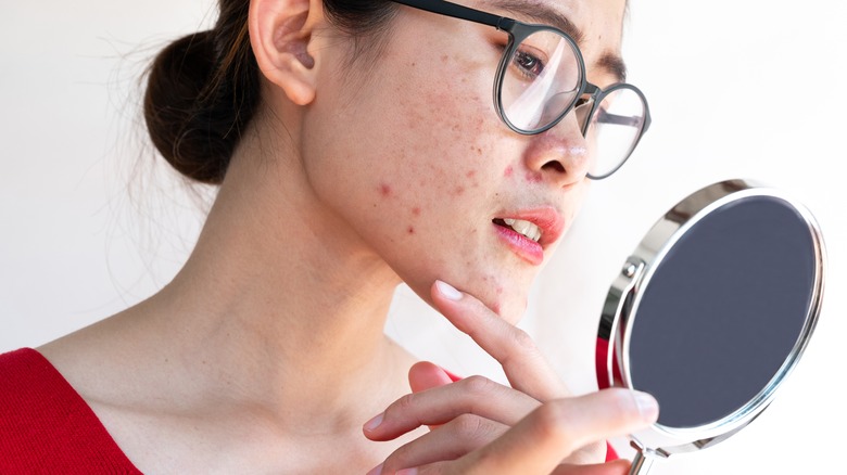 Woman looking at acne