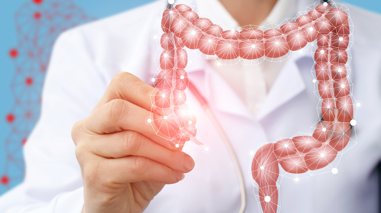 Image of large intestines and doctor