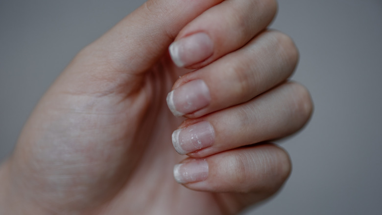 Close up of hand with fingers curved to expose nails