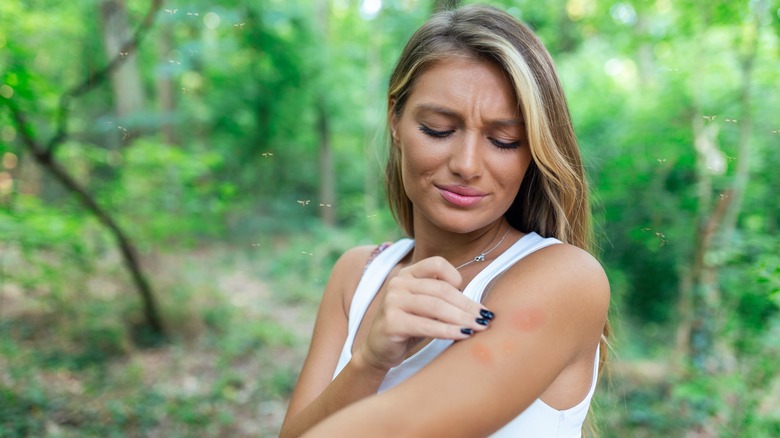 Woman itching insect bite