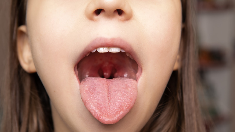 girl with open mouth and visible tonsils