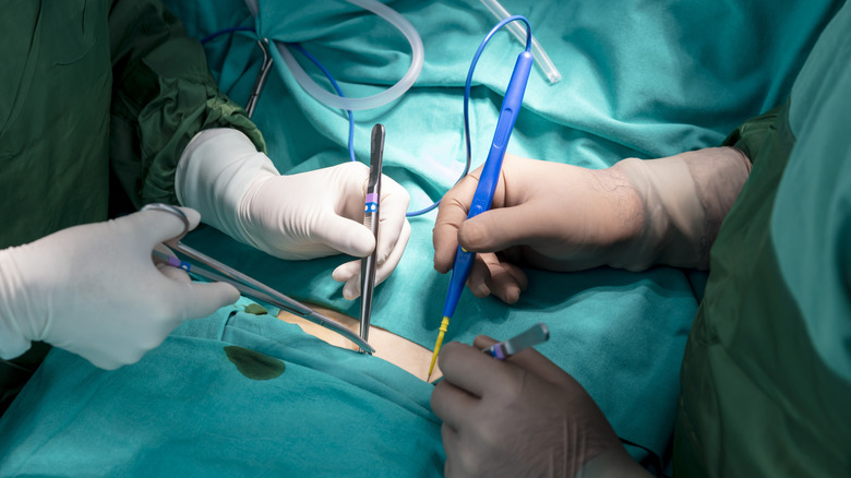 two surgeons operating on patient